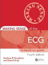 Making Sense of the ECG: A Hands-On Guide