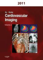 Cardiovascular Imaging -2Vol-Reddy