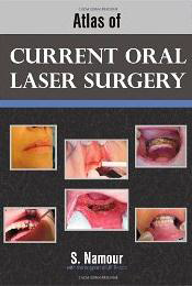 Atlas of Current Oral Laser Surgery