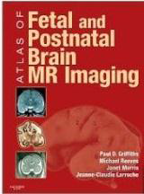Atlas of Fetal and Postnatal Brain MR
Imaging