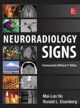 Neuroradiology Signs