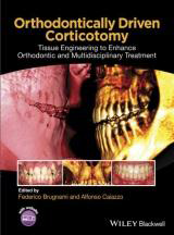 Orthodontically Driven Corticotomyt