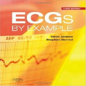 آموزش ECG با مثال