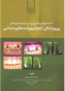 دانستنیهای ضروری درباره بیماری های پریودنتال، لثه و ایمپلنت های دندانی