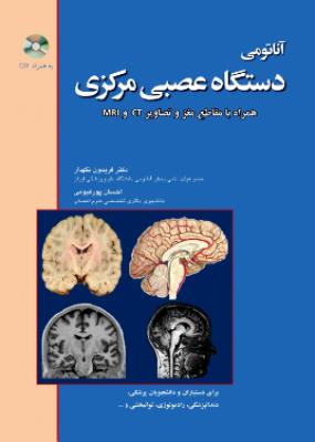 آناتومی دستگاه عصبی مرکزی همراه با مقطع مغز و تصاویر CT و MRI