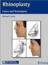 Rhinoplasty: Cases and Techniques