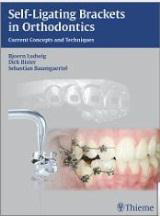 Self-ligating Brackets in Orthodontics:
Current Concepts and Techniques