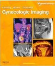 Gynecologic Imaging